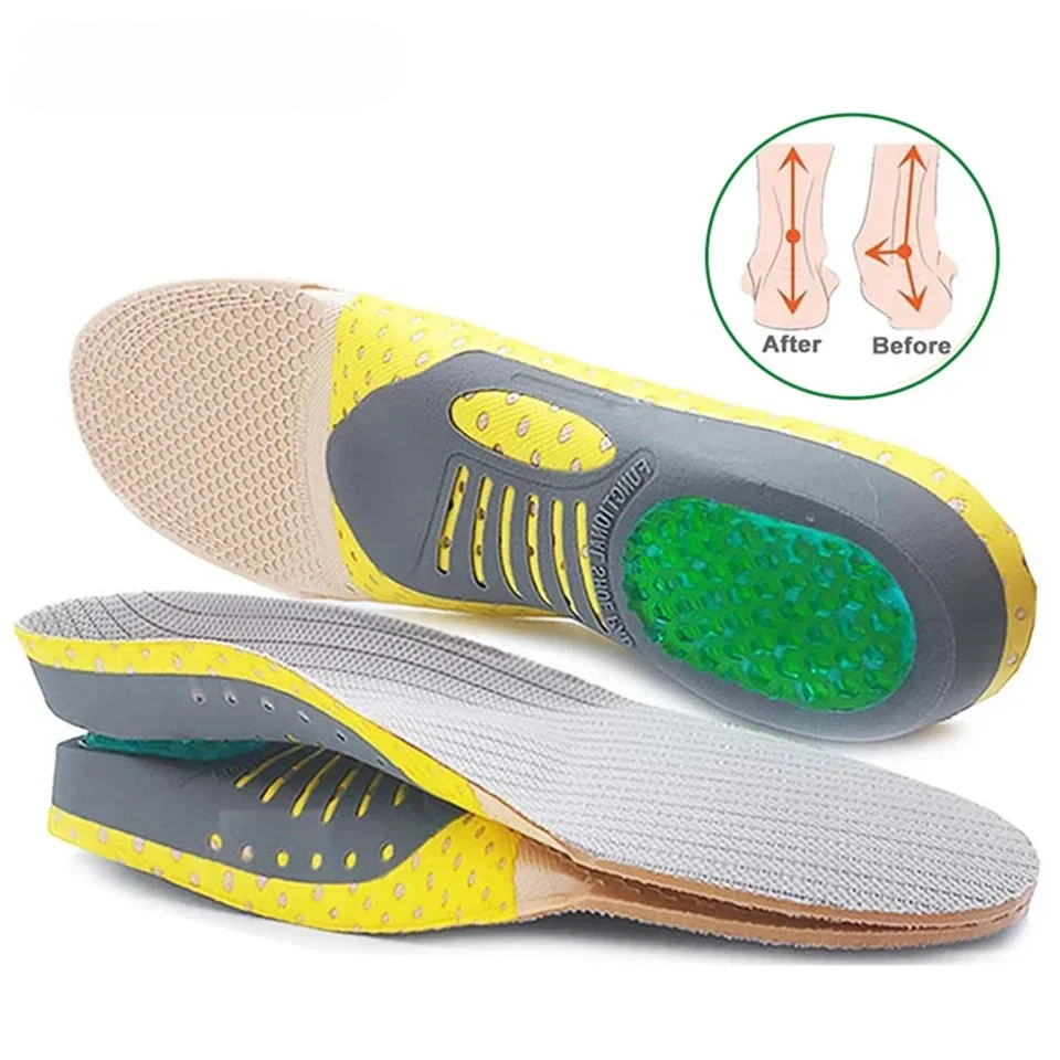 INS 101: Arch Support Orthopedic Insoles